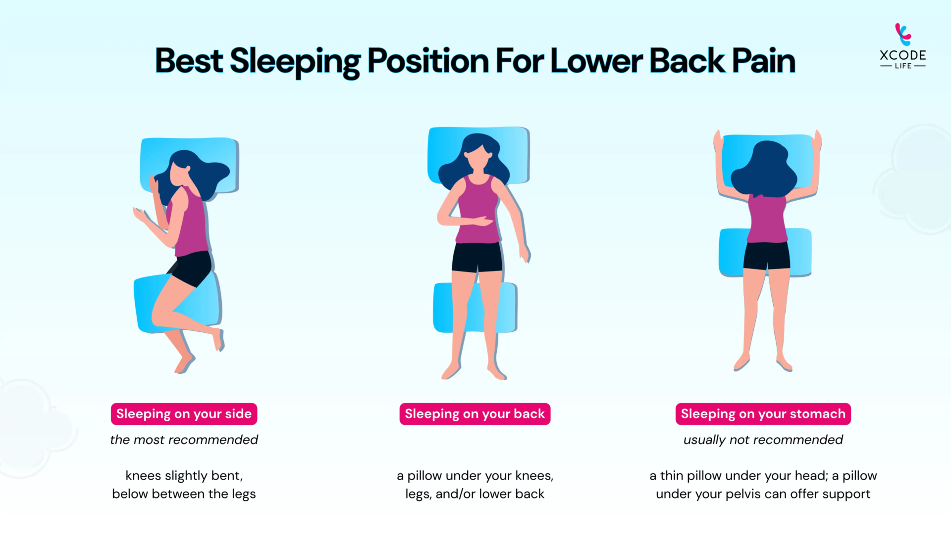 Illustration titled “Best Sleeping Position for Lower Back Pain” showing three sleeping positions. On the left, a woman sleeping on her side with knees slightly bent and a pillow between her legs, labeled as the most recommended position. In the center, a woman sleeping on her back with pillows placed under the knees and lower back for support. On the right, a woman sleeping on her stomach with a thin pillow under the head and optional pelvic support, labeled as usually not recommended. Xcode Life logo appears in the right upper corner.